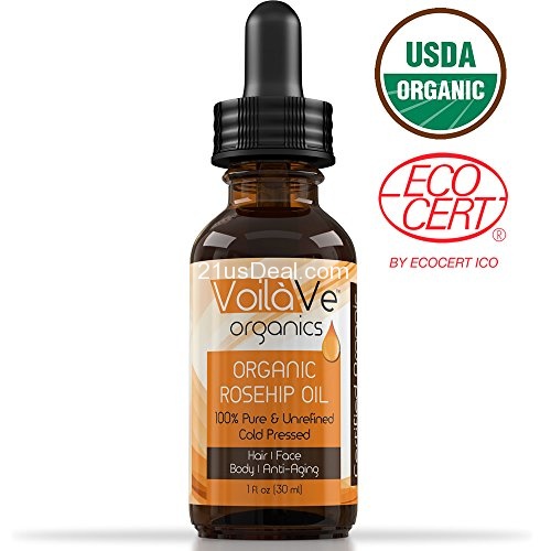 Amazon-Only $13.99 ORGANIC Rosehip Oil - 100% Pure & ECO Certified Organic - #1 Rosehip Oil - Great For Face, Dry Skin, Dermatitis, Brittle Nails, Psoriasis, Eczema, Dry Hair, Scars, Anti-Aging, & More! - Larger 1 oz Bottle - 100% Guaranteed to Work Wonders for Your Body!